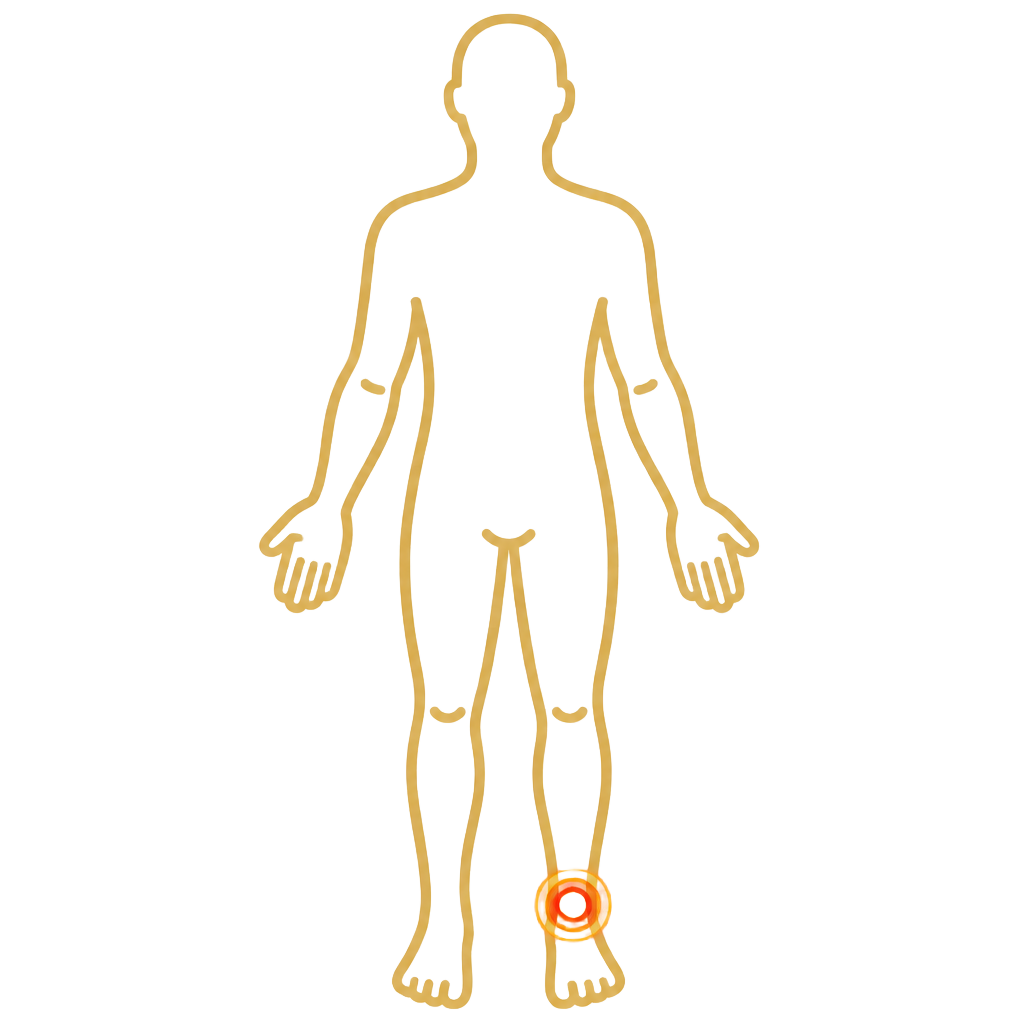 Ankle Pain anatomical illustration