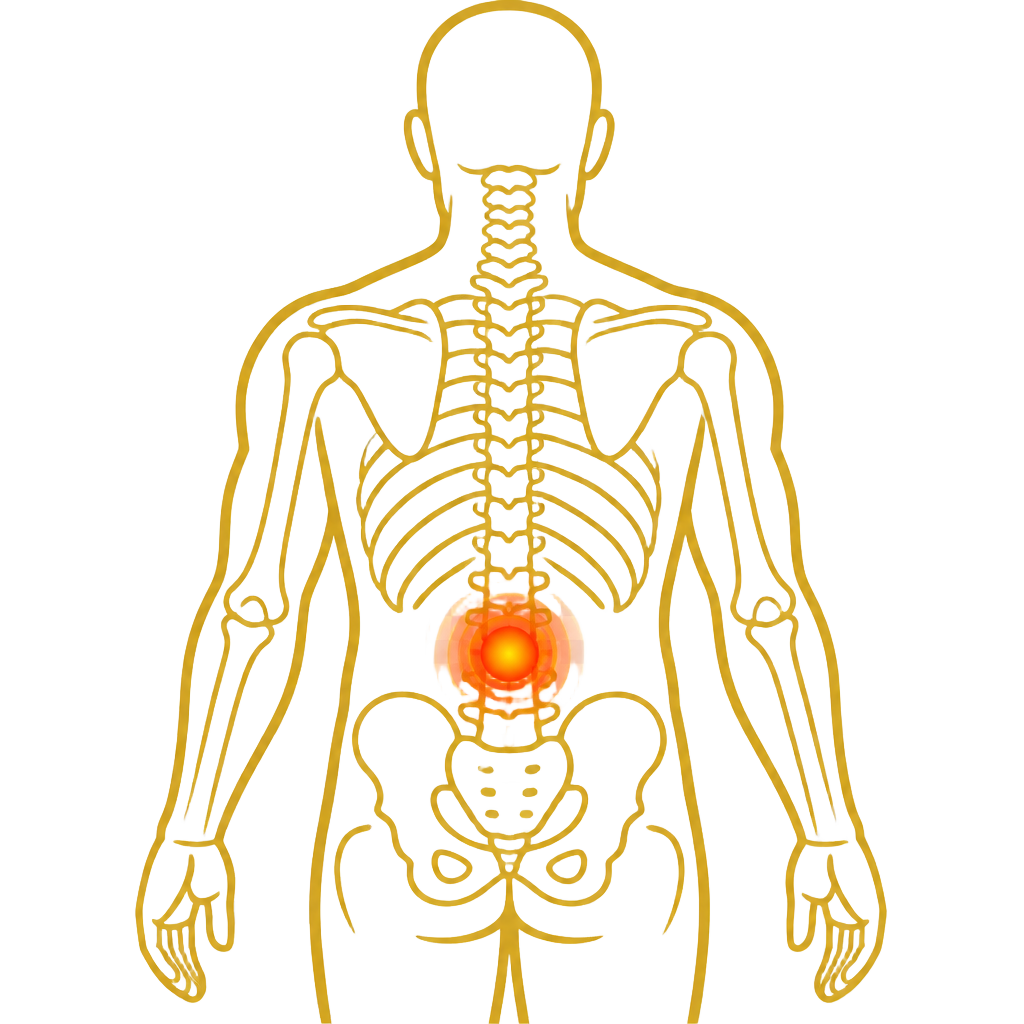 Back Pain anatomical illustration