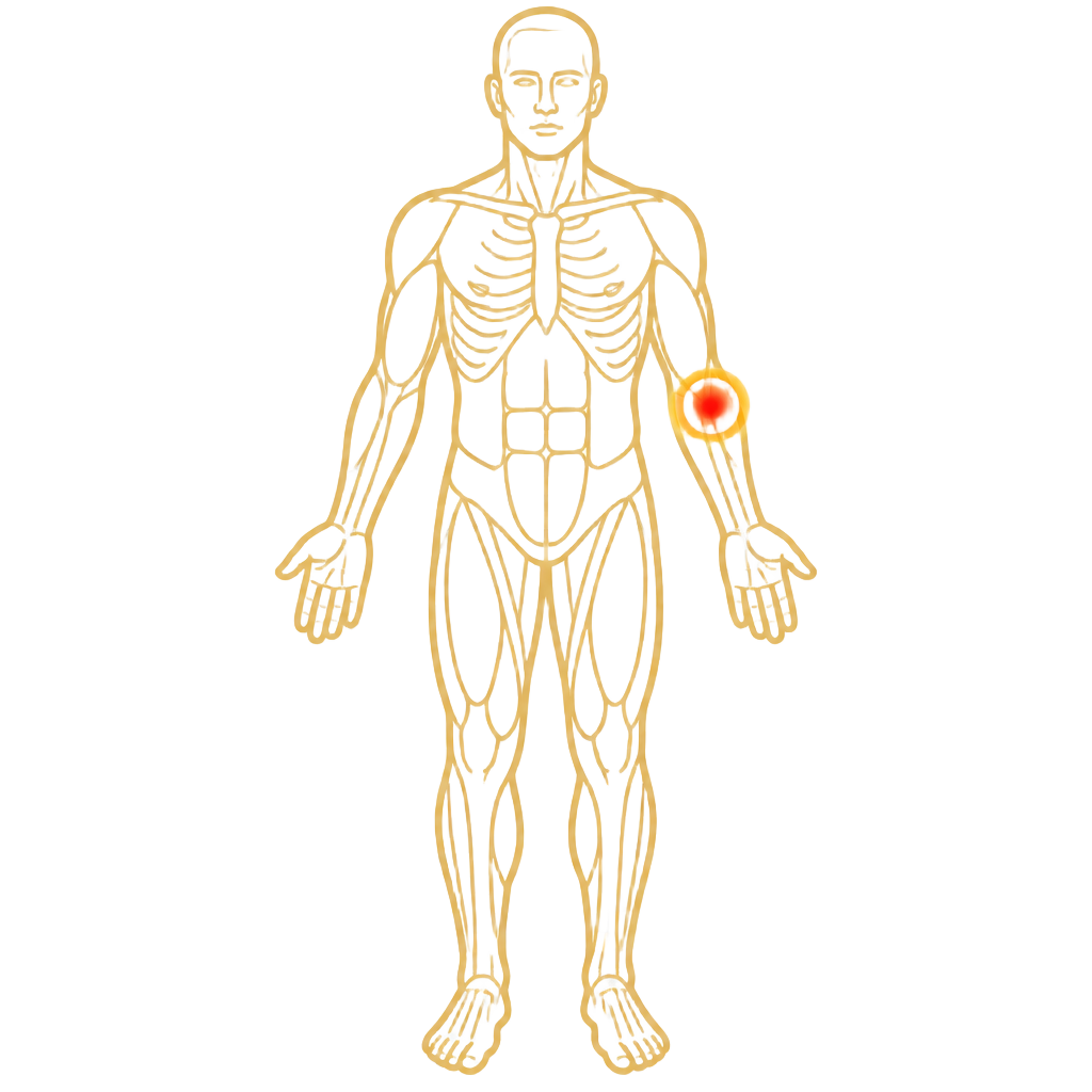 Elbow Pain anatomical illustration
