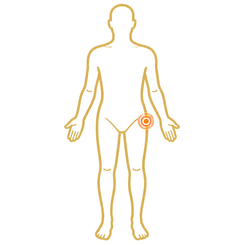 Hip Pain anatomical illustration