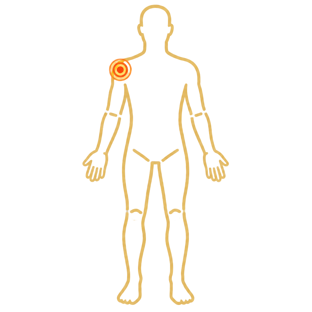 Shoulder Pain anatomical illustration