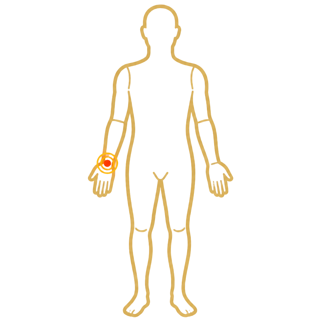 Wrist Pain anatomical illustration
